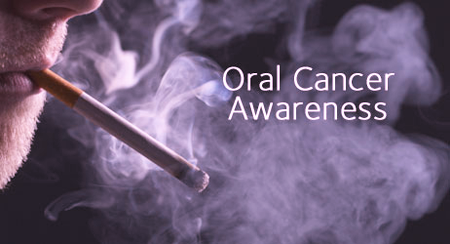 smoke and oral cancer