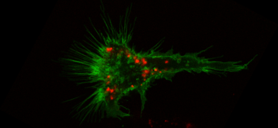 Macrophage phagocytosing ecoli