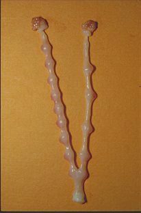 Stimulated Uterine Horn